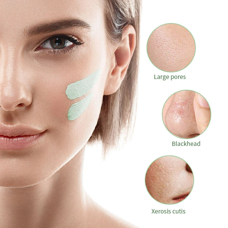 masque anti-acné pour femmes,